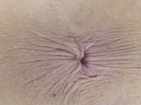 300人の尻穴 第2集　サンプル画像08